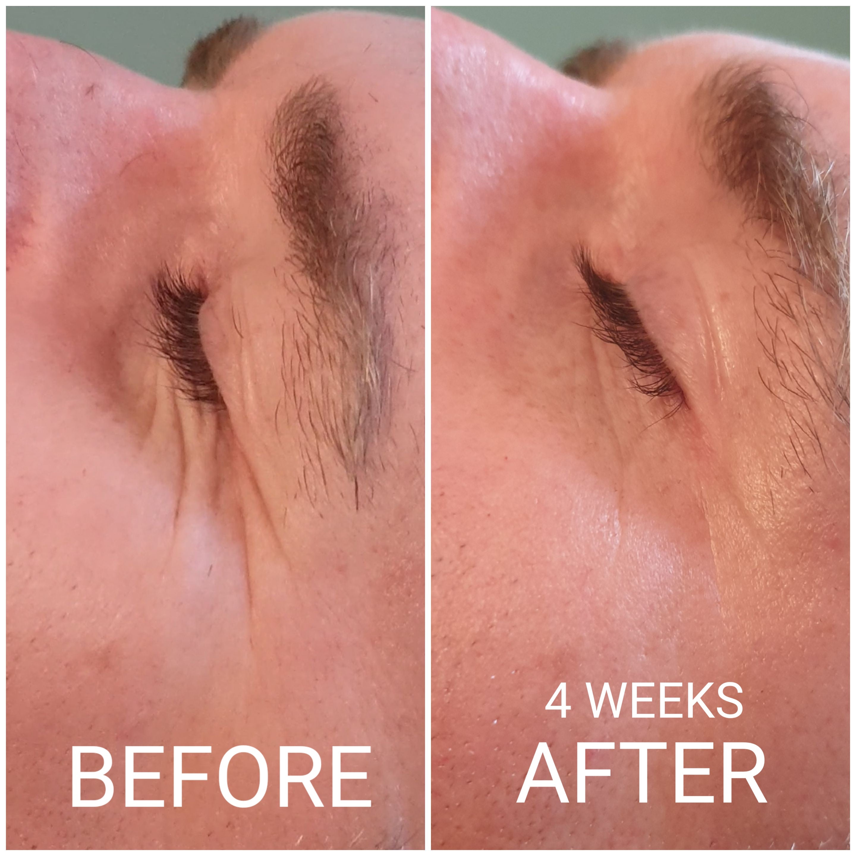 Before And After Results Of Humanity Cosmetics Cleansing Gel